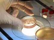 子宫内膜异位对试管有影响吗？有成功案例有吗？